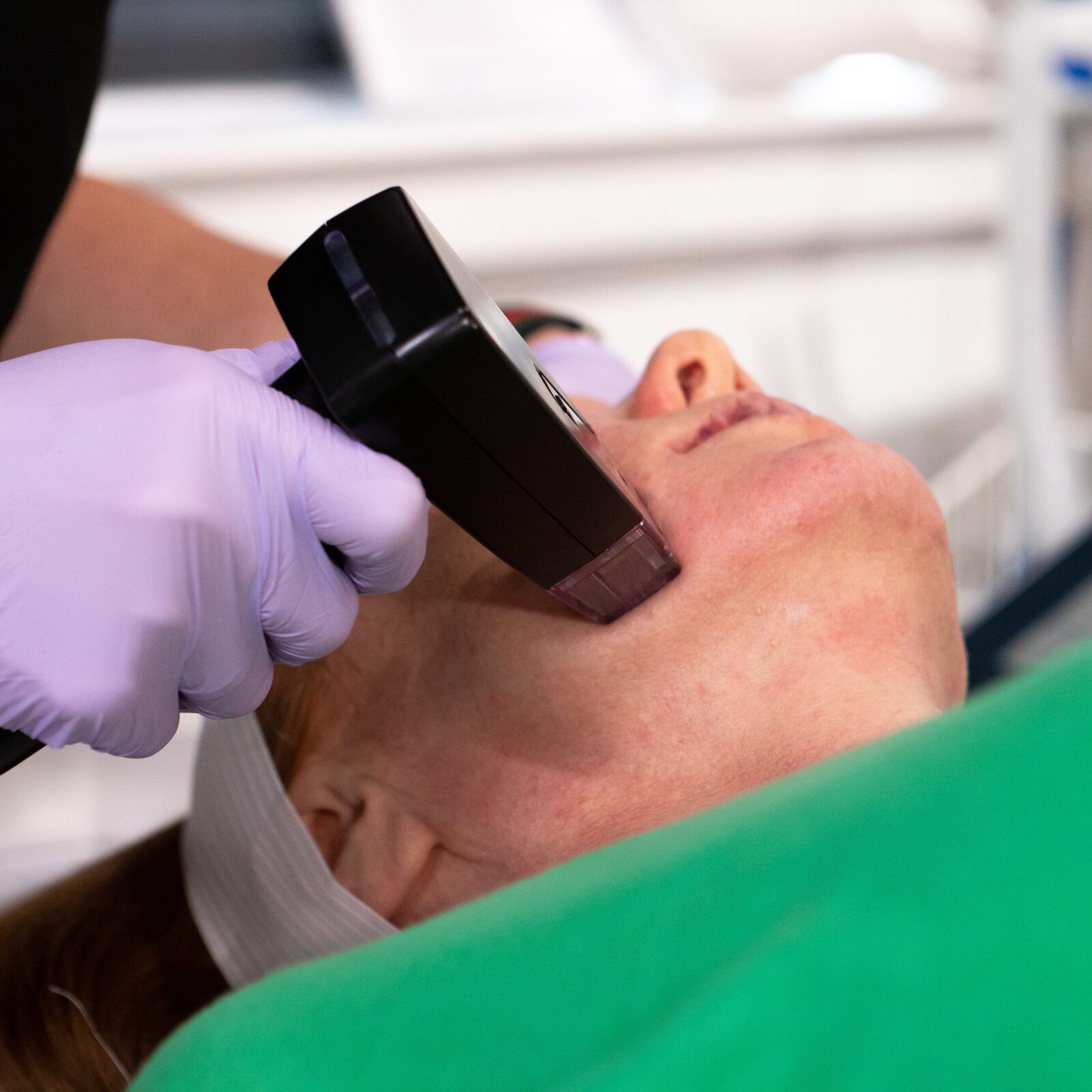 Morpheus8 body contouring at RevIV